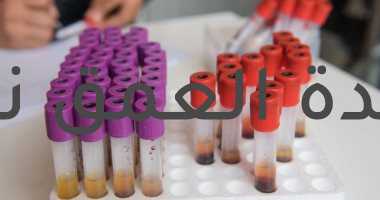 تحليل الهوموسيستين يكشف نقص حمض الفوليك فى الدم