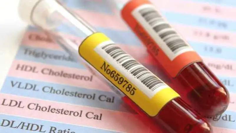 بشرى سارة لمن يتناولون أدوية السكري والكوليسترول(العمق نيوز)