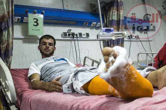 التجمع الأكبر لجراحي العظام يناقش أحدث العلاجات لضحايا الحروب دون اللجوء لـ«البتر»